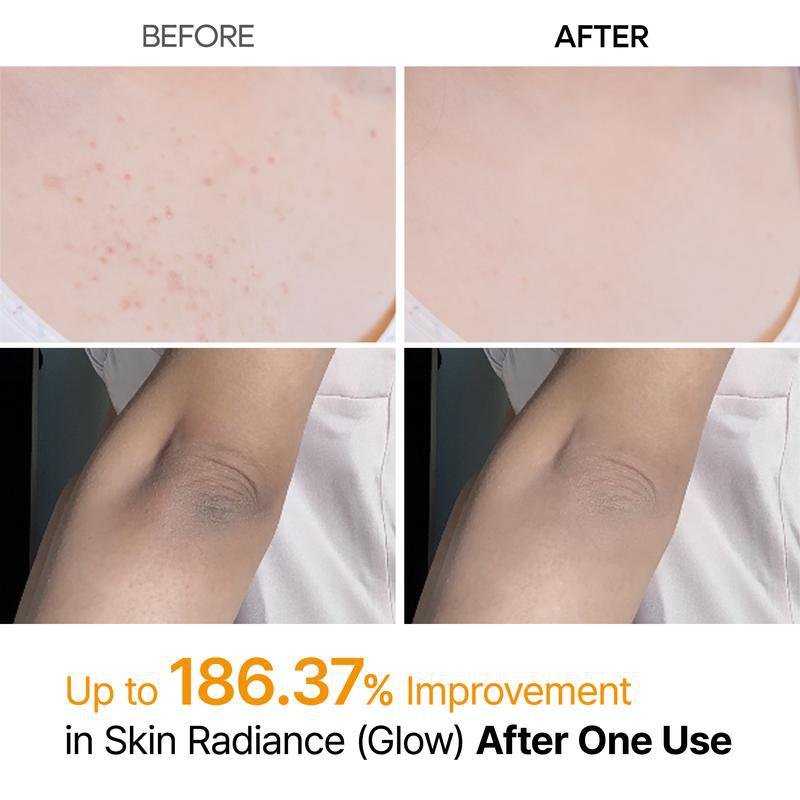 turmeric & kojic acid exfoliating spray turmeric & kojic acid exfoliating spray
